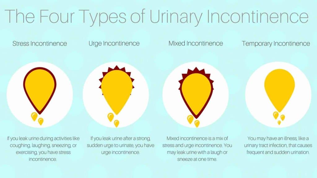 Diagram showing the four types of urinary incontinence