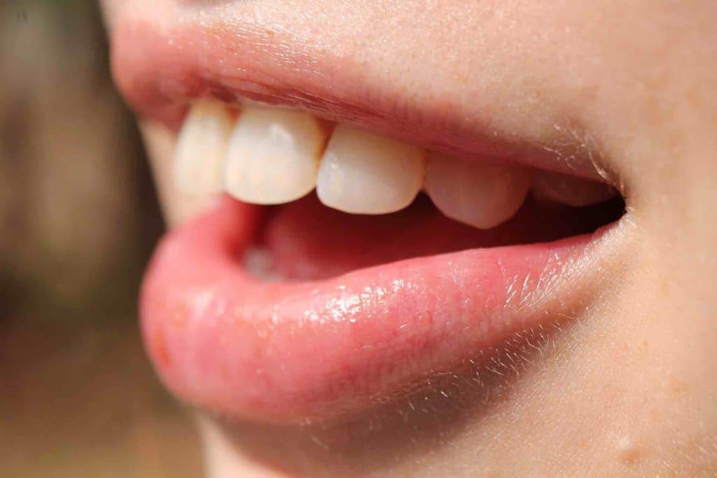 Close-up picture of a healthy mouth