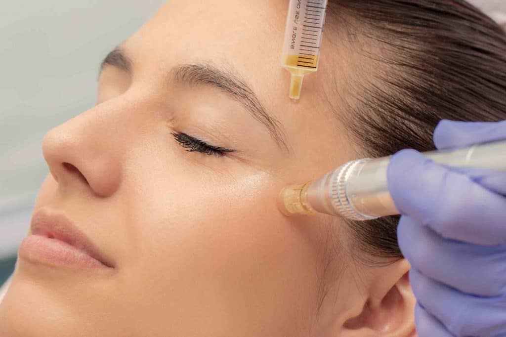 Woman getting plasma skin tightening treatment