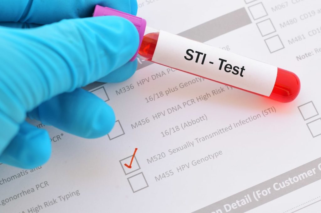 STI test tube and form being completed